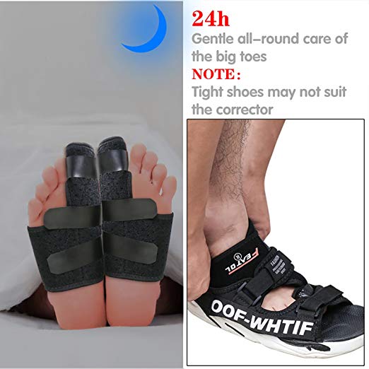 [amazon] Featol Orthopedic Bunion Corrector & Splint, Bunion Protector